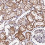 RPAP2 Antibody in Immunohistochemistry (Paraffin) (IHC (P))
