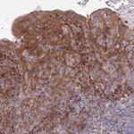 RPAP2 Antibody in Immunohistochemistry (Paraffin) (IHC (P))
