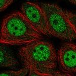 NFKBIL2 Polyclonal Antibody