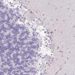 NFKBIL2 Antibody in Immunohistochemistry (Paraffin) (IHC (P))