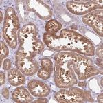 NFKBIL2 Antibody in Immunohistochemistry (Paraffin) (IHC (P))