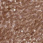 NFKBIL2 Antibody in Immunohistochemistry (Paraffin) (IHC (P))
