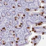 REG4 Antibody in Immunohistochemistry (Paraffin) (IHC (P))