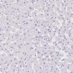REG4 Antibody in Immunohistochemistry (Paraffin) (IHC (P))