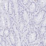 REG4 Polyclonal Antibody