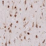 TMEM229B Antibody in Immunohistochemistry (Paraffin) (IHC (P))