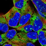 RPL18 Polyclonal Antibody