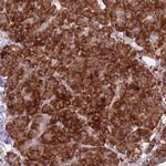 RPL18 Antibody in Immunohistochemistry (Paraffin) (IHC (P))