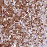 RPL18 Antibody in Immunohistochemistry (Paraffin) (IHC (P))