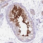 RPL18 Antibody in Immunohistochemistry (Paraffin) (IHC (P))