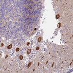 Alsin Antibody in Immunohistochemistry (Paraffin) (IHC (P))