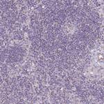 Alsin Antibody in Immunohistochemistry (Paraffin) (IHC (P))