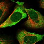 SGK494 Polyclonal Antibody