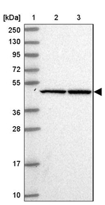 SGK494 Antibody in Western Blot (WB)