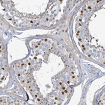 ZFPM1 Antibody in Immunohistochemistry (Paraffin) (IHC (P))