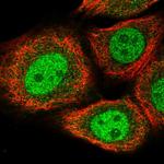 BRMS1L Polyclonal Antibody