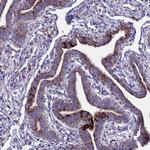 ZNFX1 Antibody in Immunohistochemistry (Paraffin) (IHC (P))
