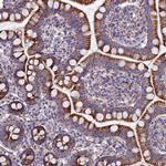 ZNFX1 Antibody in Immunohistochemistry (Paraffin) (IHC (P))