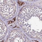ZNFX1 Antibody in Immunohistochemistry (Paraffin) (IHC (P))