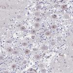 CENPQ Polyclonal Antibody