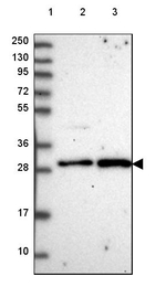CENPQ Antibody in Western Blot (WB)