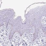 SCAMP5 Polyclonal Antibody