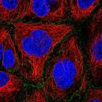 FLVCR1 Polyclonal Antibody