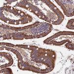 T126A Antibody in Immunohistochemistry (Paraffin) (IHC (P))