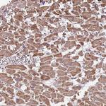 T126A Antibody in Immunohistochemistry (Paraffin) (IHC (P))