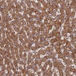 T126A Antibody in Immunohistochemistry (Paraffin) (IHC (P))