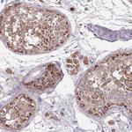 T126A Polyclonal Antibody