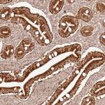 ZNF776 Antibody in Immunohistochemistry (Paraffin) (IHC (P))