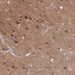 SHC3 Antibody in Immunohistochemistry (Paraffin) (IHC (P))