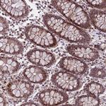 SHC3 Antibody in Immunohistochemistry (Paraffin) (IHC (P))