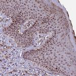 SHC3 Antibody in Immunohistochemistry (Paraffin) (IHC (P))