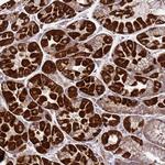 FBXO33 Antibody in Immunohistochemistry (Paraffin) (IHC (P))
