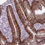 ZNF667 Polyclonal Antibody