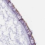 ZNF239 Polyclonal Antibody