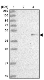 ZNF239 Antibody in Western Blot (WB)