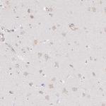 ATP8B2 Antibody in Immunohistochemistry (Paraffin) (IHC (P))