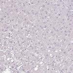 ATP8B2 Antibody in Immunohistochemistry (Paraffin) (IHC (P))