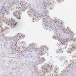 ATP8B2 Antibody in Immunohistochemistry (Paraffin) (IHC (P))