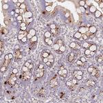 ATP8B2 Polyclonal Antibody