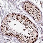 FCF1 Antibody in Immunohistochemistry (Paraffin) (IHC (P))