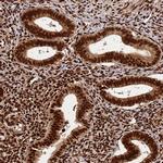 hnRNP AB Antibody in Immunohistochemistry (Paraffin) (IHC (P))