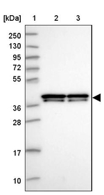 hnRNP AB Antibody in Western Blot (WB)