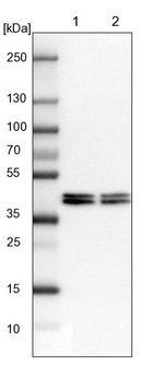 hnRNP AB Antibody in Western Blot (WB)