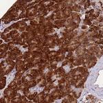 FAM153B Polyclonal Antibody