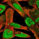 ZNF322A Polyclonal Antibody