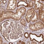ZNF322A Antibody in Immunohistochemistry (Paraffin) (IHC (P))